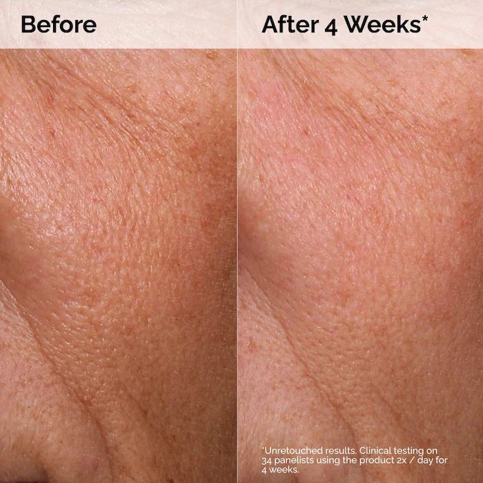 سرم آبرسان هیالورونیک اسید 2% + B5 اوردینری حجم 60 میلی لیتر